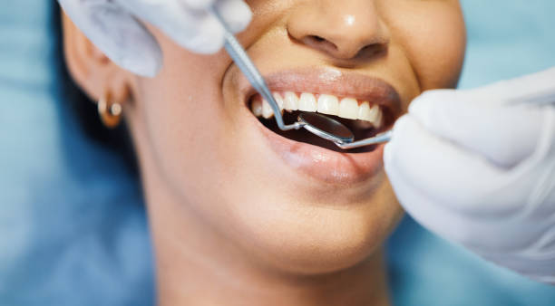 Best Emergency Dentist for Lost Fillings or Crowns in Kalida, OH